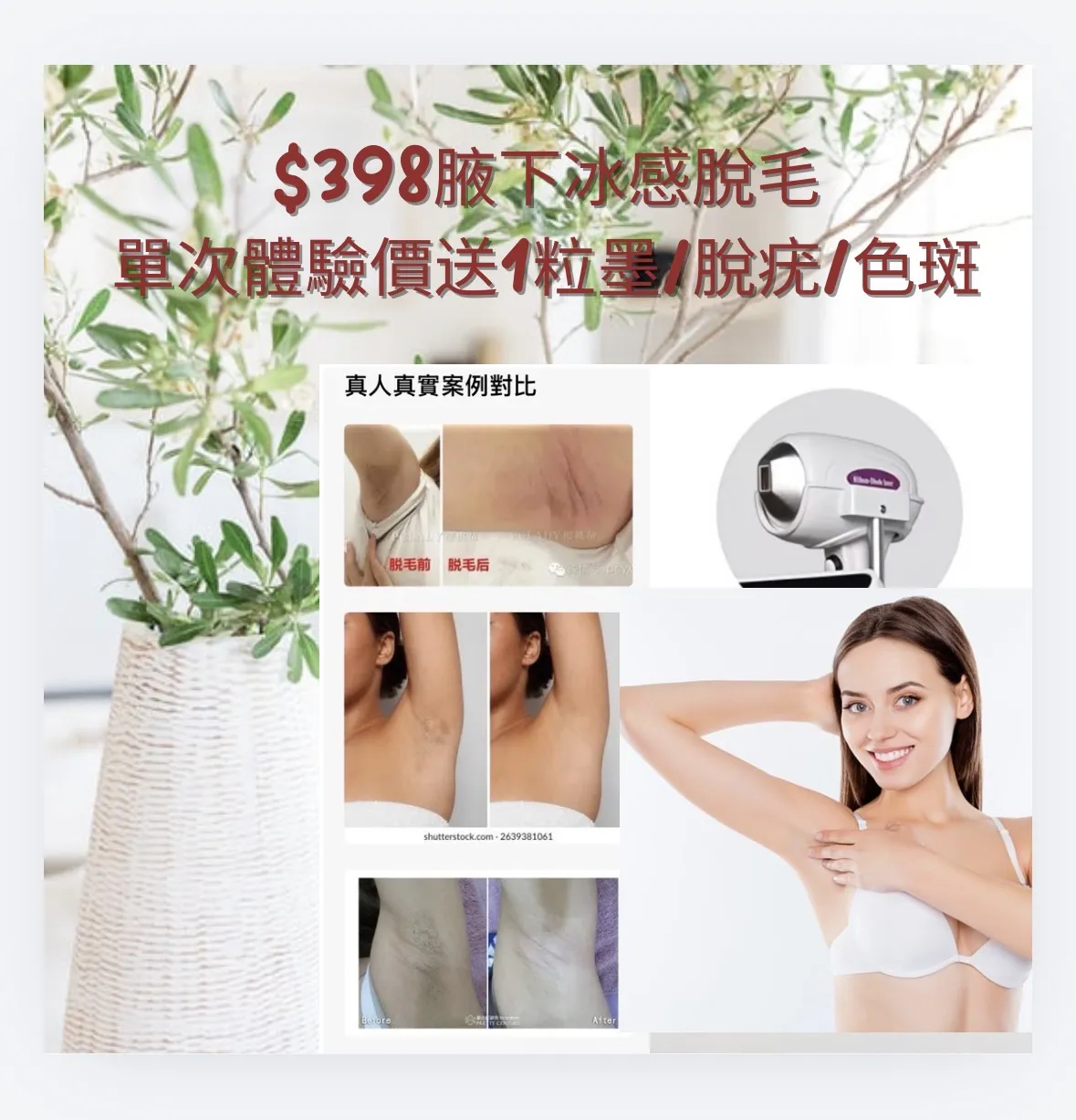$398腋下冰感脫毛單次體驗價 限時優惠送1粒墨/脫疣/色斑🌻🌻🌻
