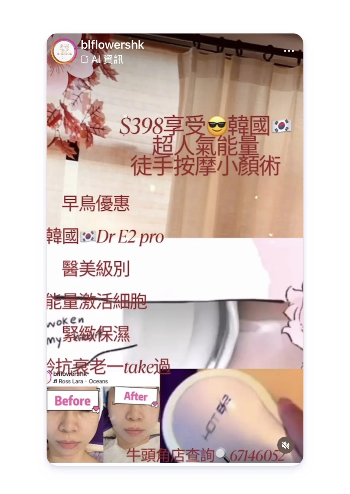 歡迎單次$398 嘆足90分鐘 韓式小顏面部按摩 💆‍♀️  🔥限時優惠 送 🇰🇷 Dr E2Pro 醫美級逆齡抗老療程 激活膠原、緊緻輪廓、抗老效果即時見到