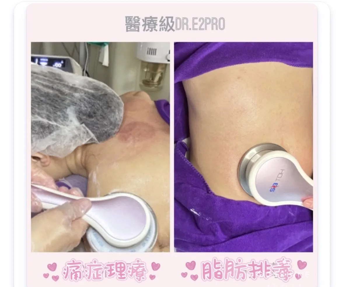 $796升級體驗90分鐘✨ DR E2 Pro細胞能量痛症舒緩理療🏆 ⚡ $796升級體驗90分鐘✨ DR E2 Pro細胞能量痛症舒緩理療🏆限時贈送香薰精油淋巴排毒按摩🧚🏻‍♀️