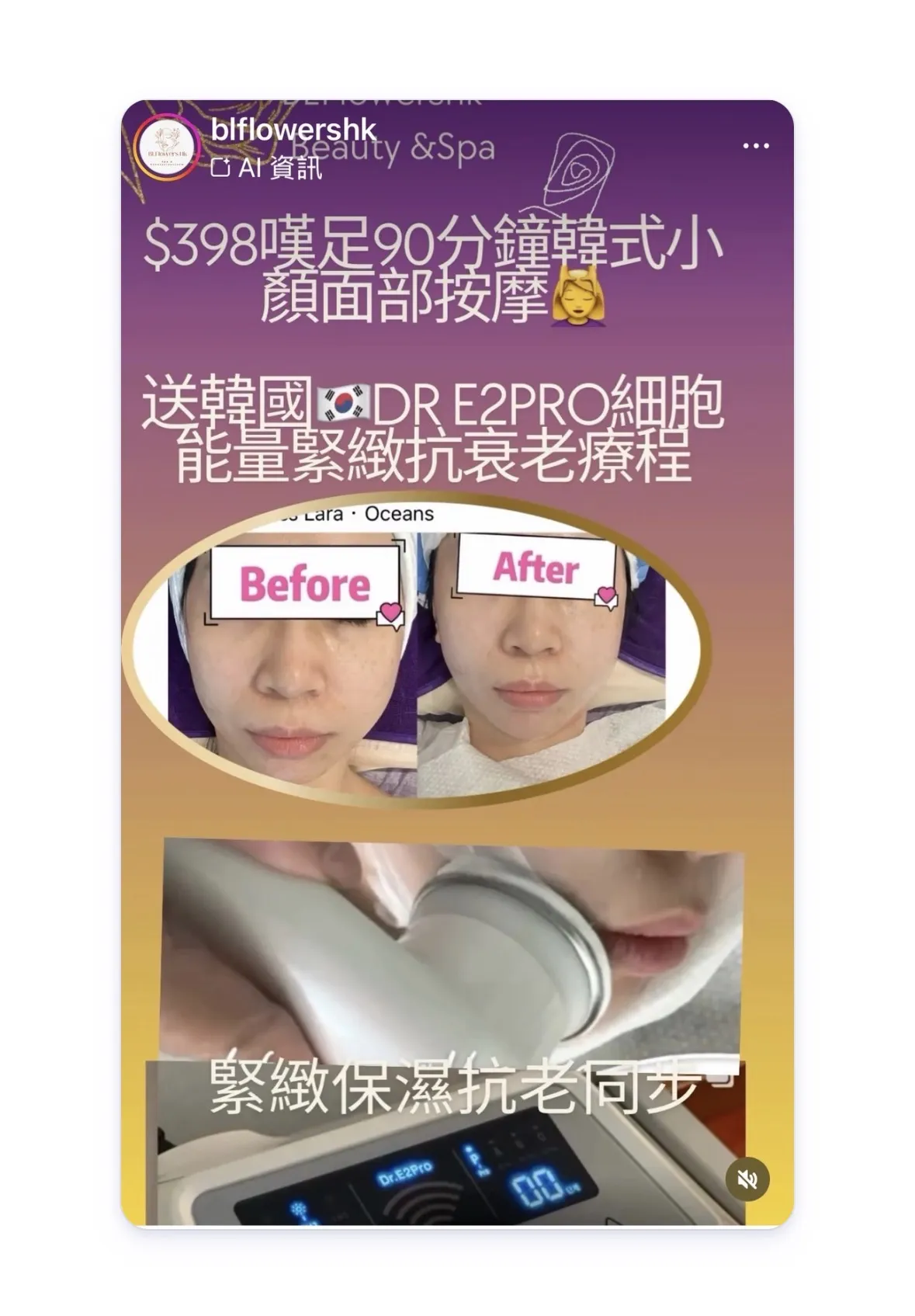 歡迎單次$398 嘆足90分鐘 韓式小顏面部按摩 💆‍♀️  🔥限時優惠 送 🇰🇷 Dr E2Pro 醫美級逆齡抗老療程 激活膠原、緊緻輪廓、抗老效果即時見到