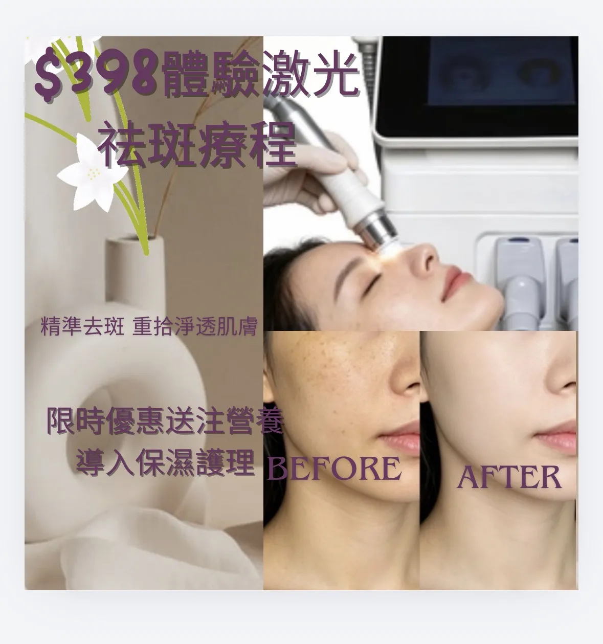 $398体验激光祛斑疗程  限时优惠🎁送注营养导入保湿护理.做完打斑都唔怕乾💦
