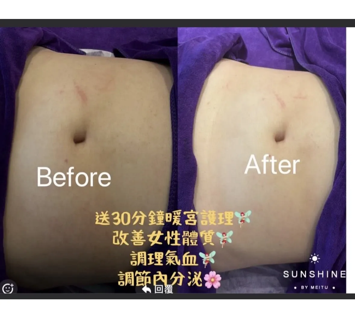 $796體驗1小時30分鐘香薰精油按摩塑形療程🌹 限時優惠送🎁溫灸能量磁叉疏通養生及Hifu原理收肚腩塑形🔥