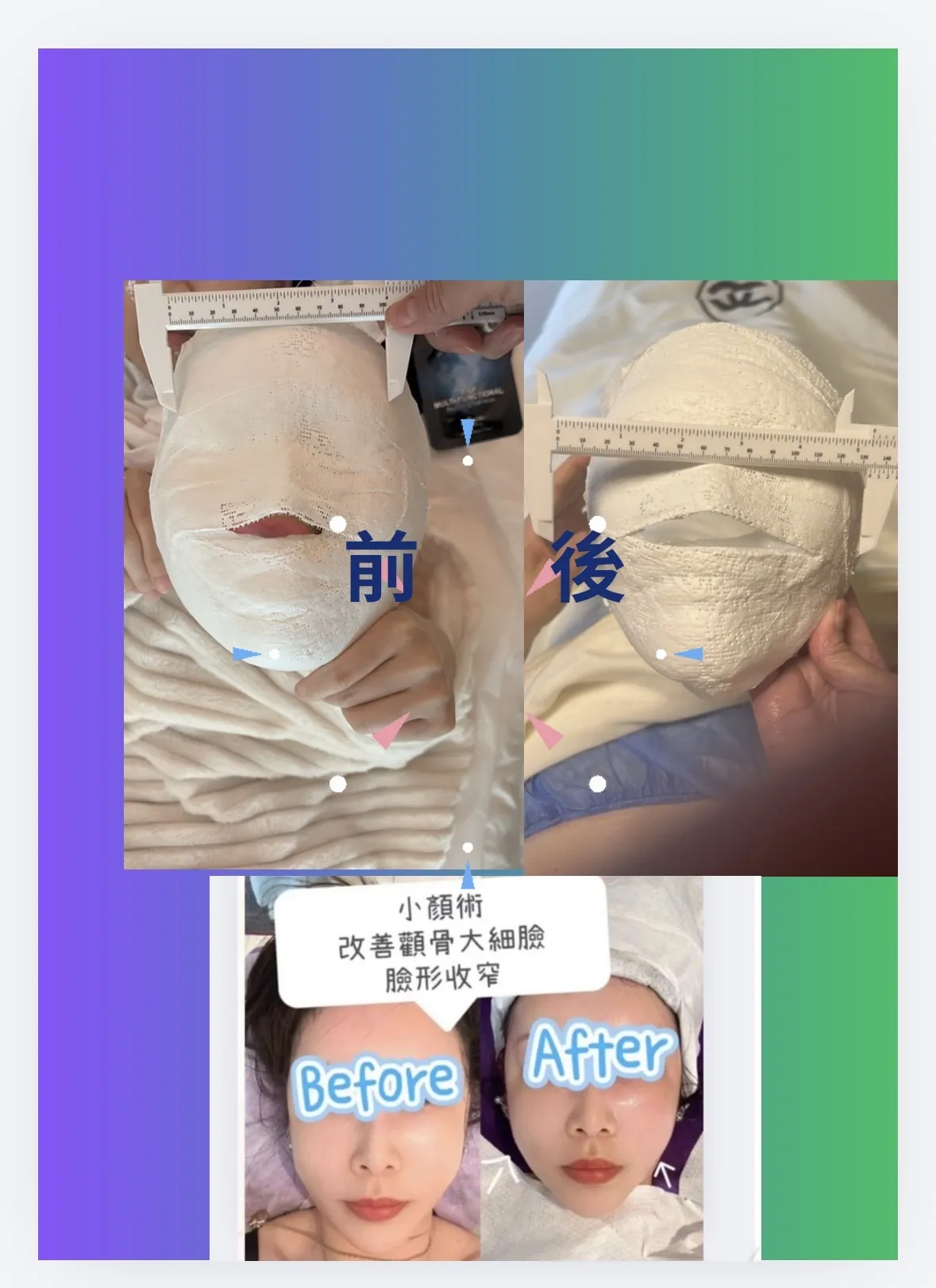 歡迎單次$398 嘆足90分鐘 韓國🇰🇷香薰小顏面部提升按摩法💆‍♀️ 訂閱點讚分享🎁美白淡斑/去印疤痕香薰精油乙支 🔥限時優惠 送 🇰🇷 Dr E2Pro 醫美級逆齡抗老修復療程