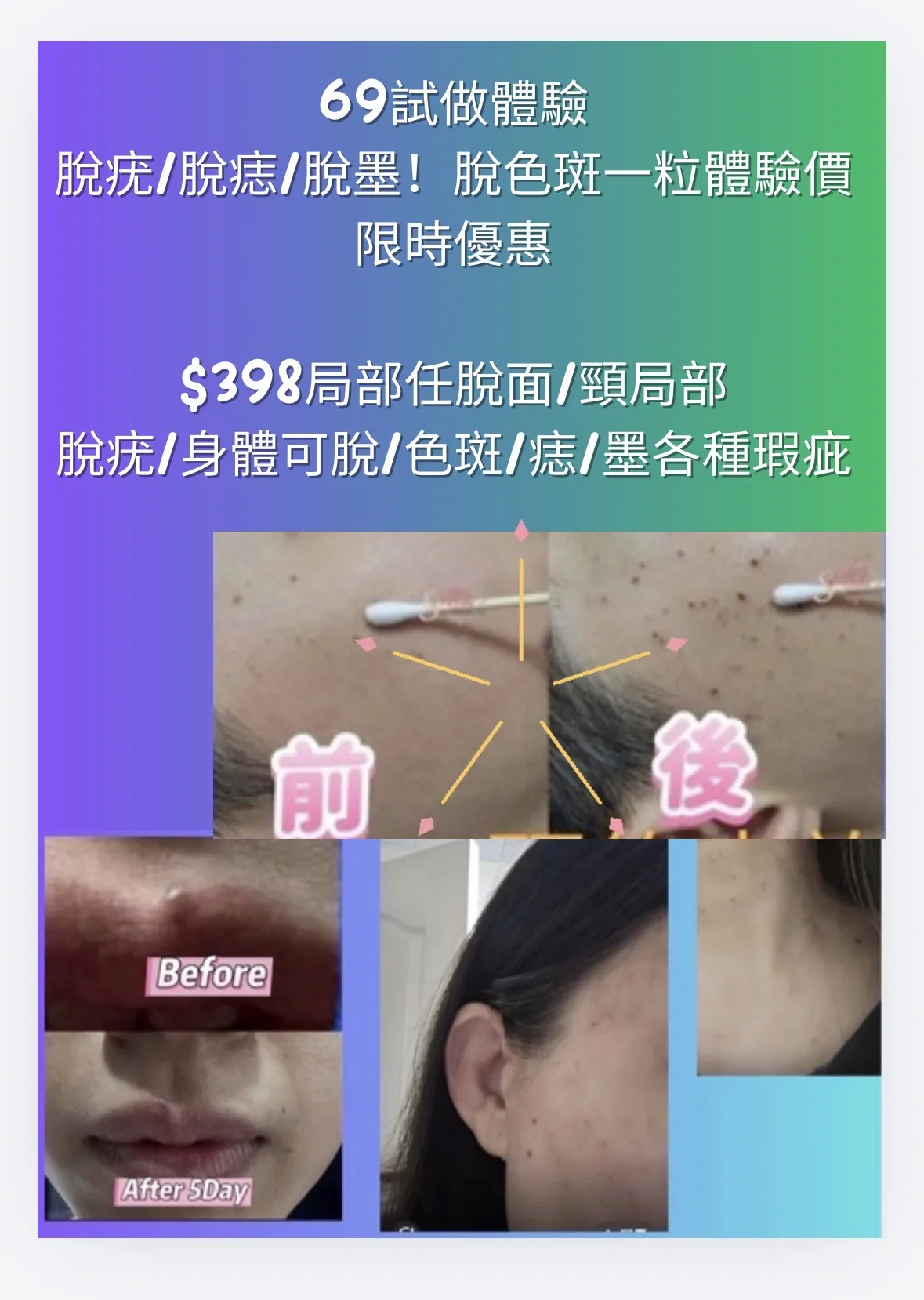 歡迎單次$398 嘆足90分鐘 韓國🇰🇷香薰小顏面部提升按摩法💆‍♀️ 訂閱點讚分享🎁美白淡斑/去印疤痕香薰精油乙支 🔥限時優惠 送 🇰🇷 Dr E2Pro 醫美級逆齡抗老修復療程