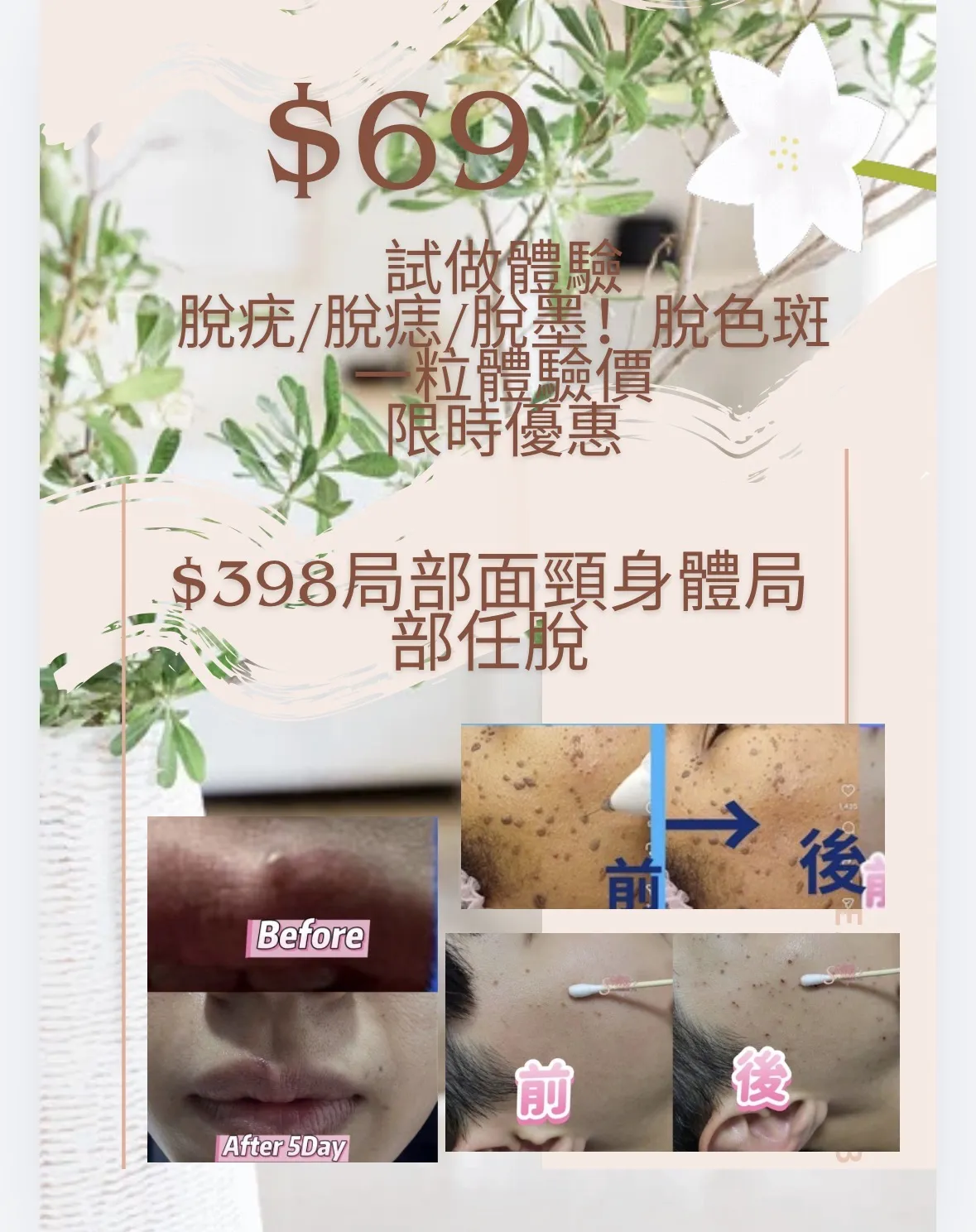 ✨$398嘆足90分鐘🌻 韓式🇰🇷香薰美白精油小顏面部按摩提升術🧚🏻‍♀️ ✨提前預約🎁免費加送Dep 無針導入爆水光肌💦注營養精華導入面部護理🧚🏻‍♀️