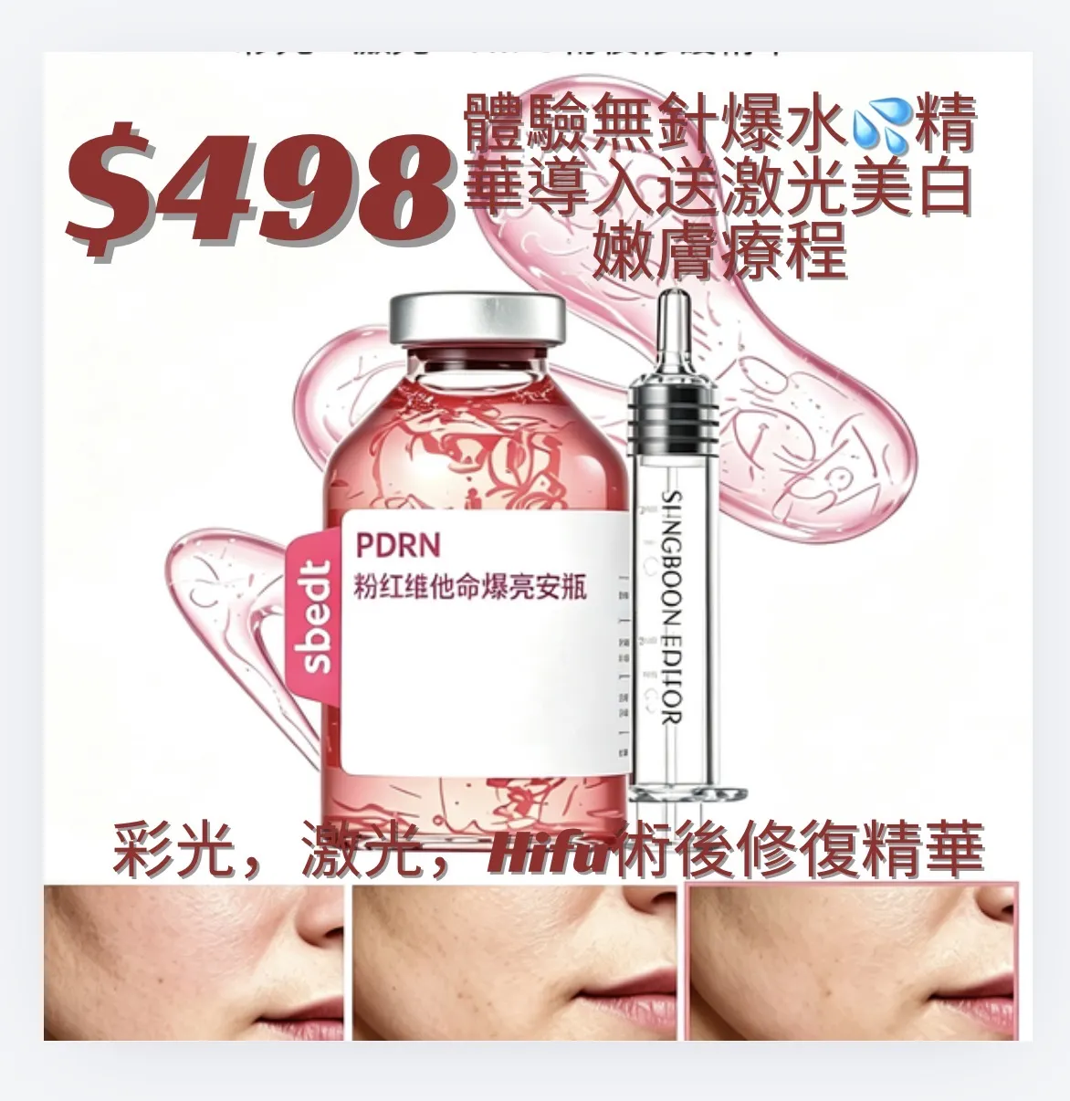 觀塘單次收費🔥$498｜無創導入三文魚PDRN精華修復護理 限時優惠🎁激光美白嫩膚療程|鈦塑局部緊緻塑形療程