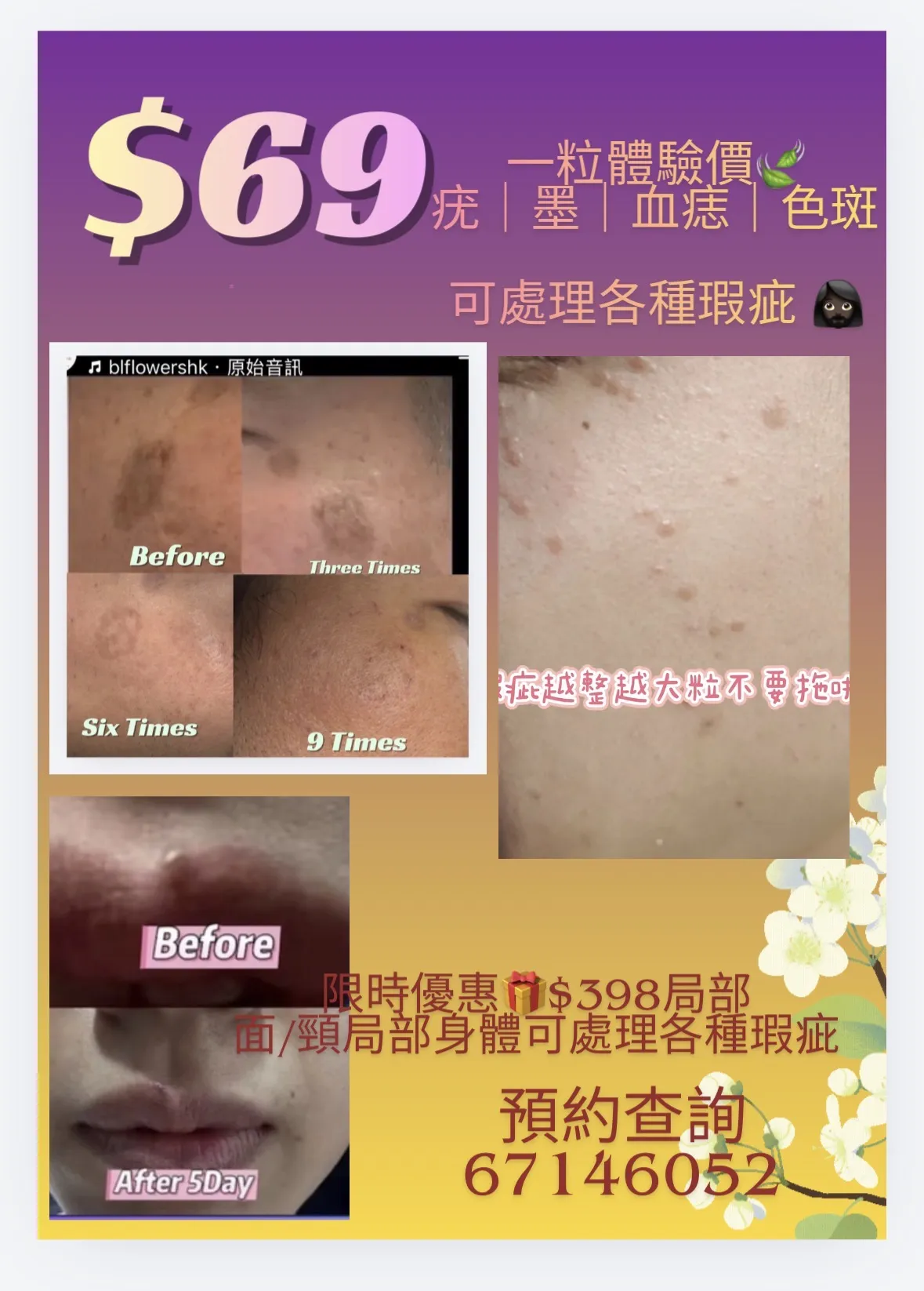 •單粒體驗 ＄69面/頸局部護理 限時升級優惠 $398局部面/頸部任脫瑕疵及• 免費送15分鐘 香薰頭/瘦面/磁叉肩頸排毒按摩
