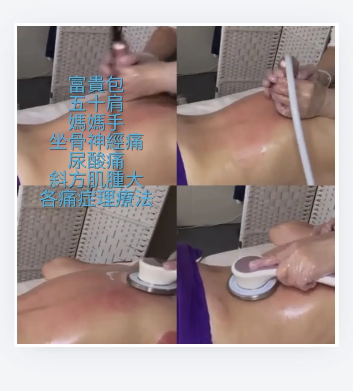 快閃⚡️ ⚡任何項目加購$398 30分鐘DR E2 Pro細胞能量痛症舒緩理療🏆