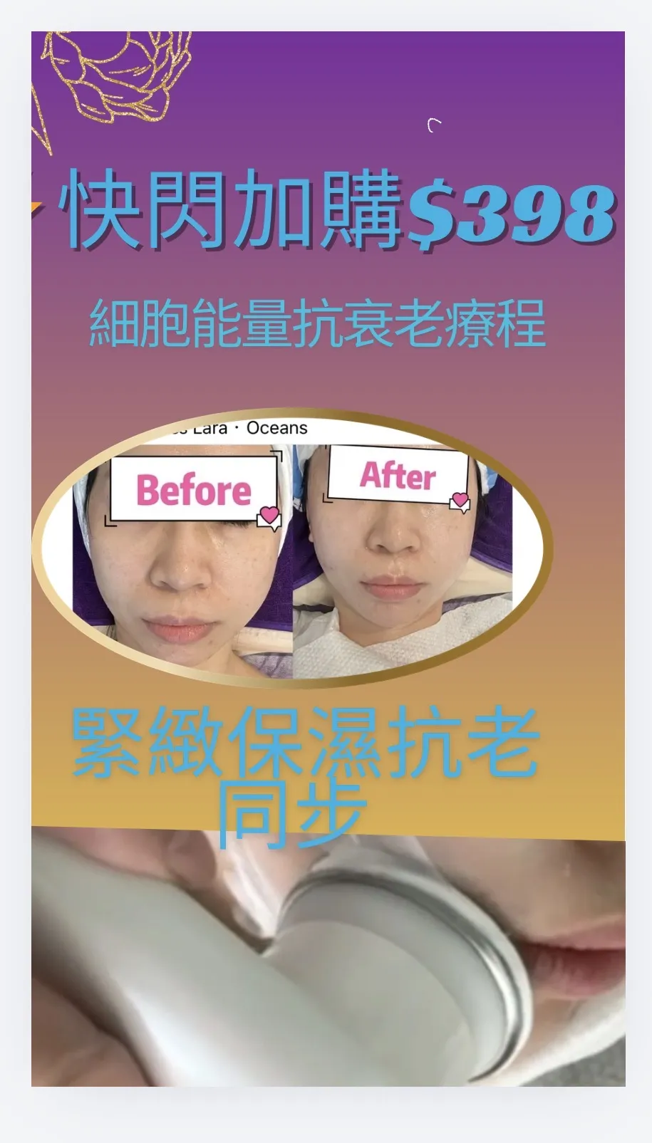 任何项目快闪⚡️加购$398 韩国🇰🇷 Dr E2Pro 医美级别🏆细胞能量役龄抗老疗程
