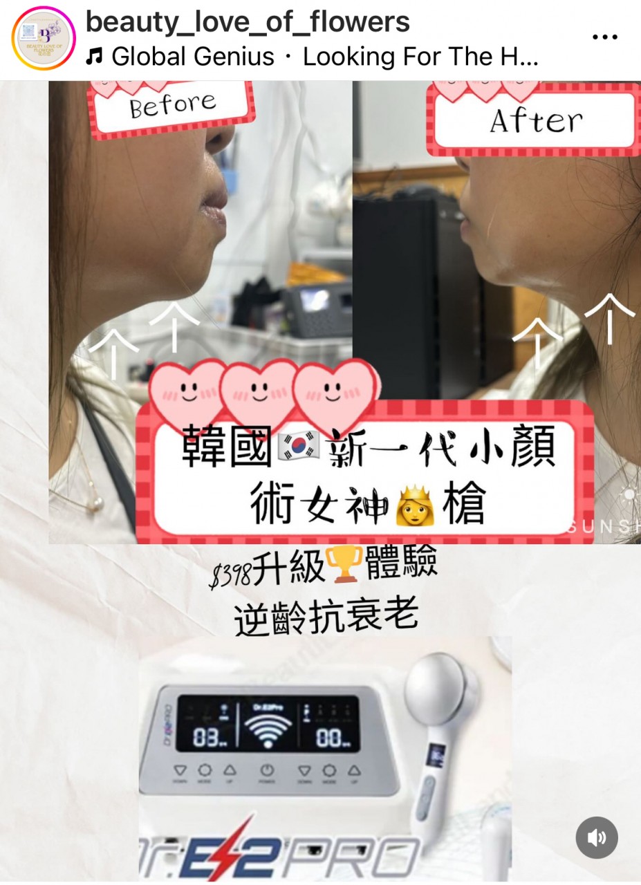 Hk00061